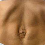 What is abdominal separation and how do I deal with…