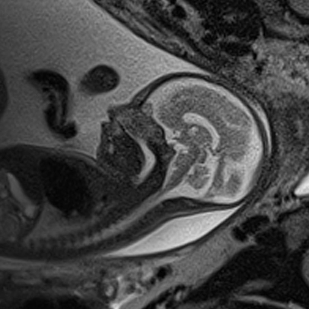 Fetal MRI: Insights from a specialist - Parenting Hub